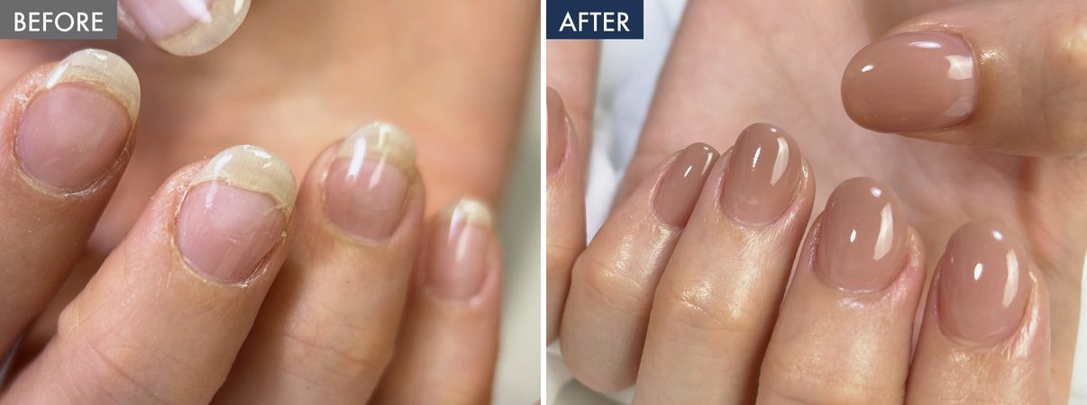 先端が白く浮いた自爪と、GINAで仕上げた後の爪