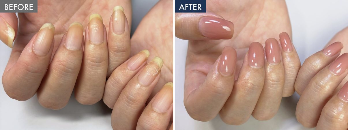 黄ばんで長さがそろわない自爪と、ピンクブラウンで仕上げた後の爪